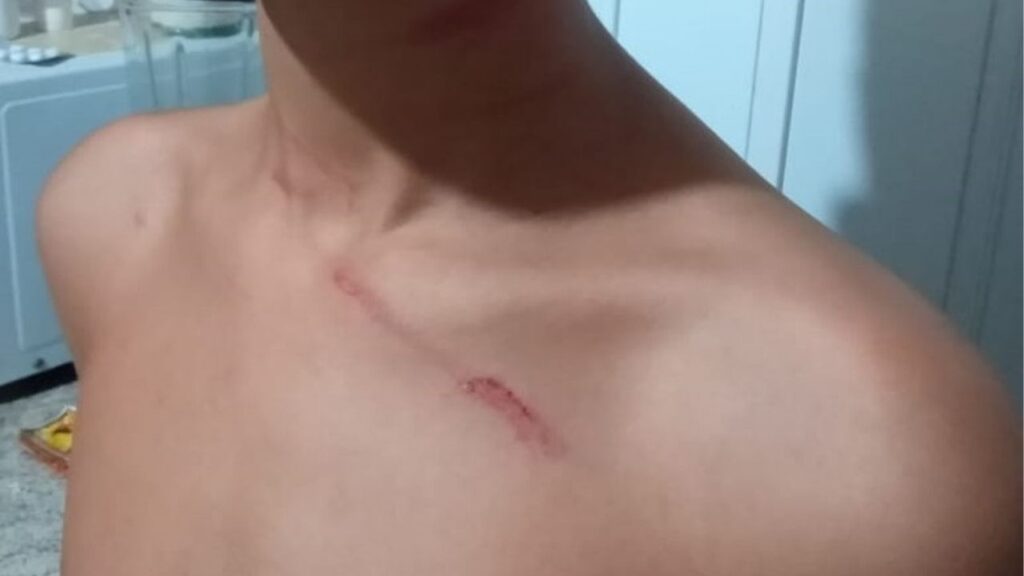 criançaagredidamundial